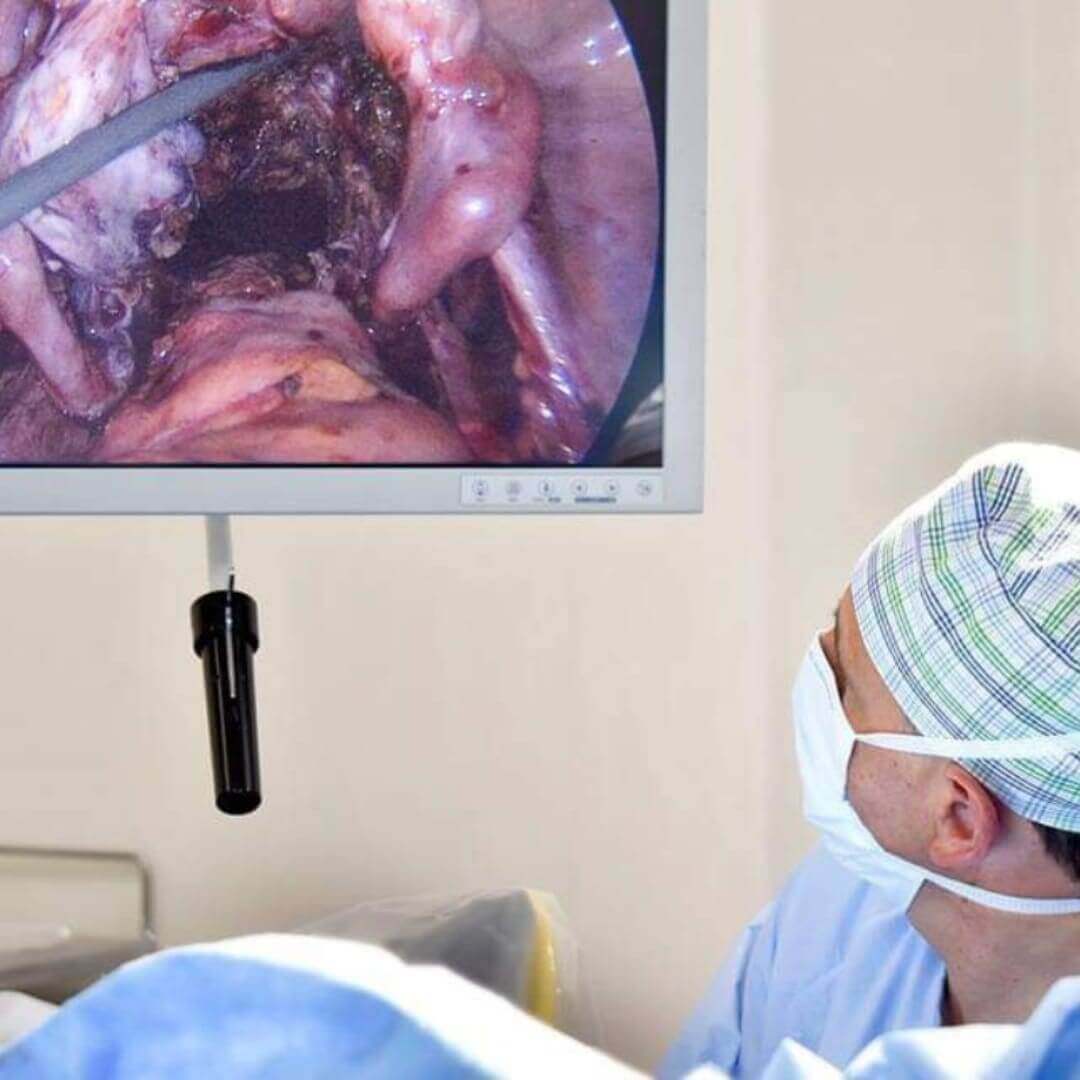 Precio de Tratamiento de Endometriosis en CDMX