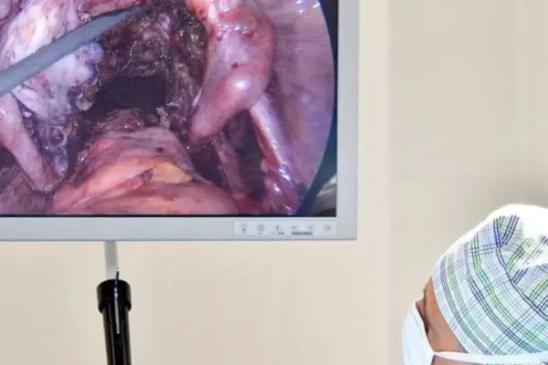 Endometriosis